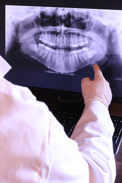 Best Emergency Dental Care for Abscessed Tooth in Shallowater, TX