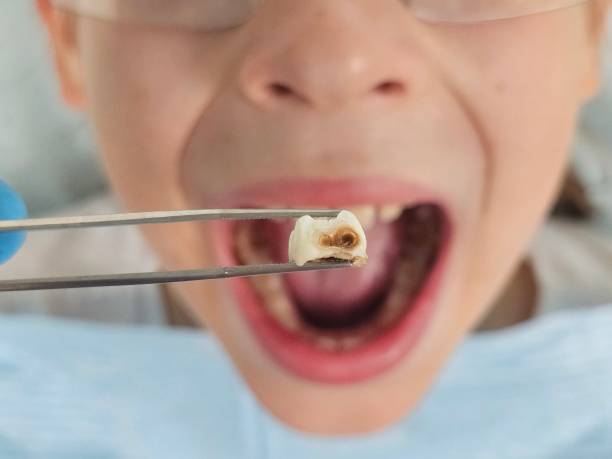Best Emergency Dental Services for Seniors in Shallowater, TX